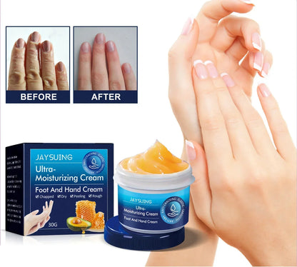 Cracked heels & Dry Hand Moisturizing Cream