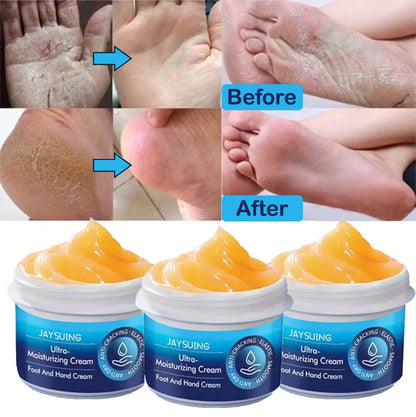 Cracked heels & Dry Hand Moisturizing Cream